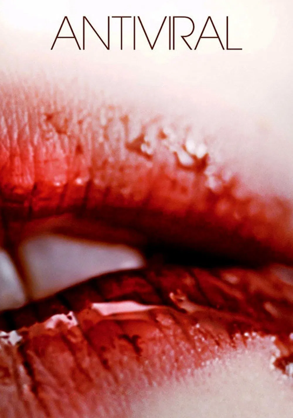 Poster chính thức của phim Phim Viễn Tưởng, Phim Kinh Dị "Chống Chọi Với Virus" (Antiviral - 2012), với sự tham gia của diễn viên Caleb Landry Jones và Sarah Gadon.