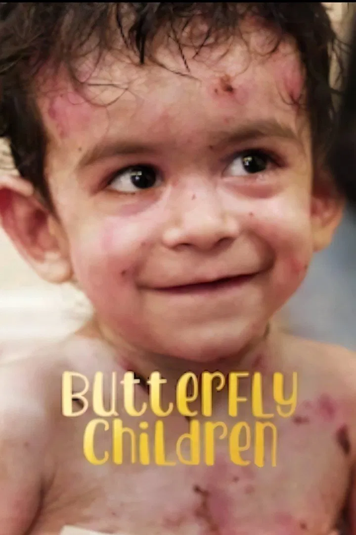 Poster chính thức của phim Phim Tài Liệu "Những đứa trẻ da cánh bướm" (Butterfly Children - 2018).